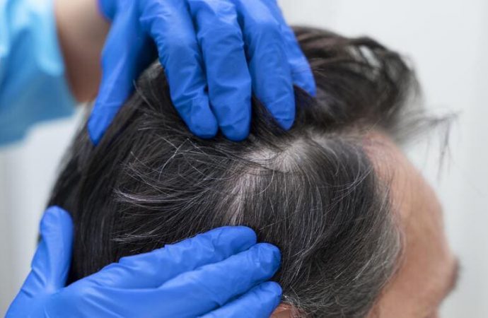 Dr Gary Roberts – tabletki na porost włosów. Jak działają i dlaczego warto je wypróbować?